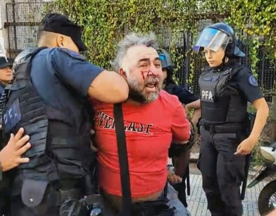 La Policía hirió y detuvo a un camarógrafo de A24 frente al Congreso